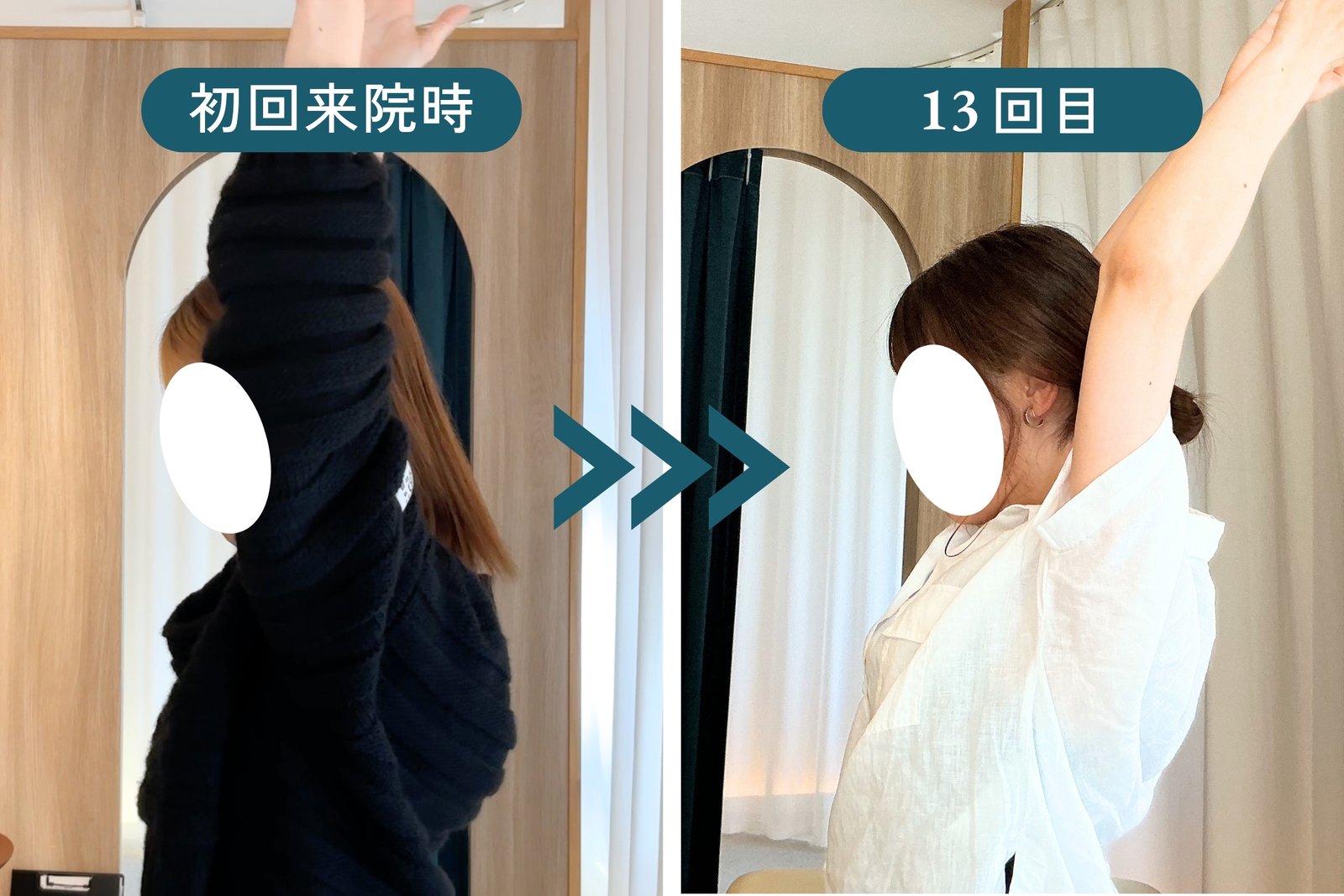 首の可動域と姿勢の変化(施術前・施術後)
