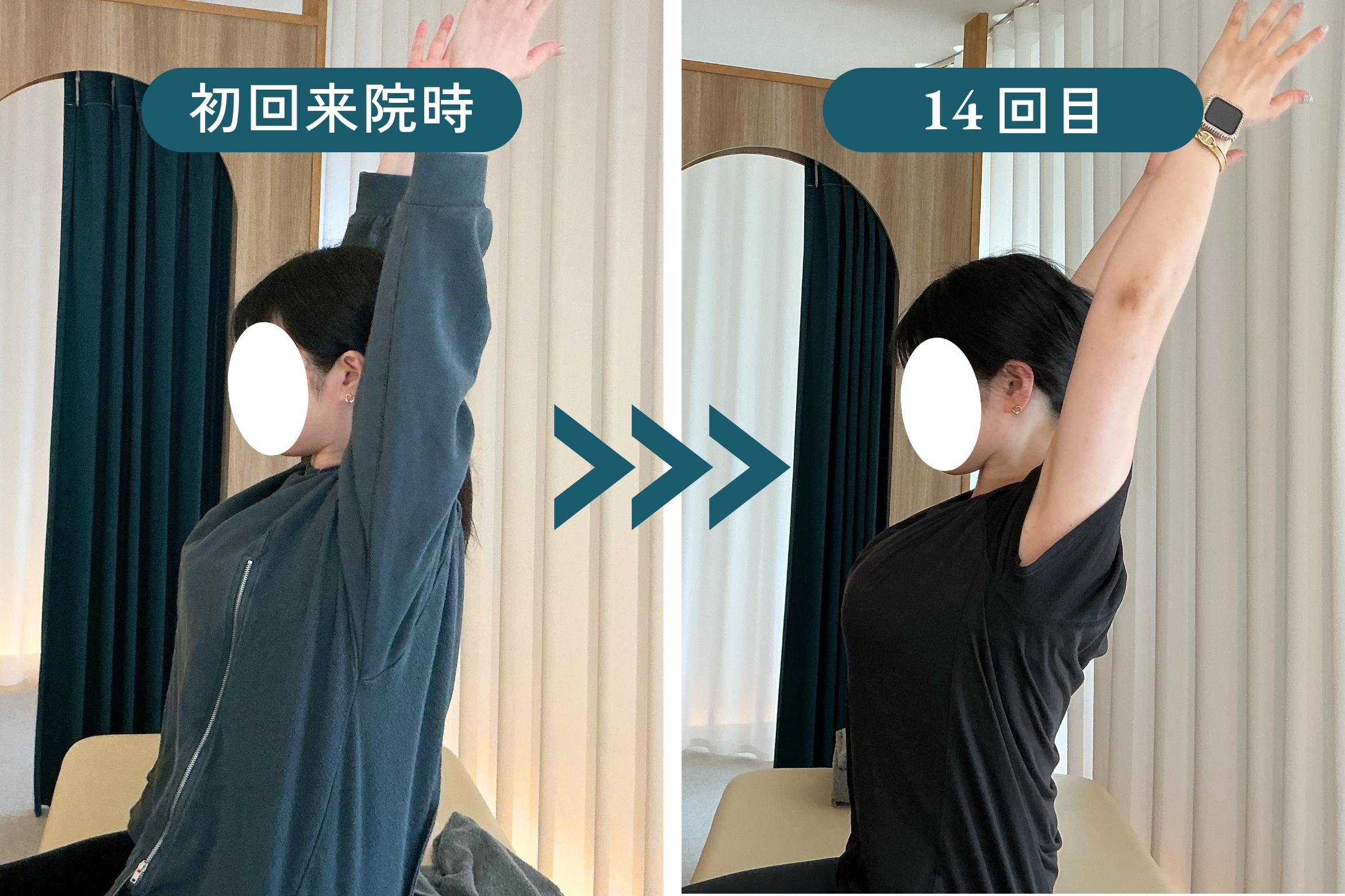 T様 初回来院時 → 14回目のビフォーアフター｜姿勢と身体感覚の変化