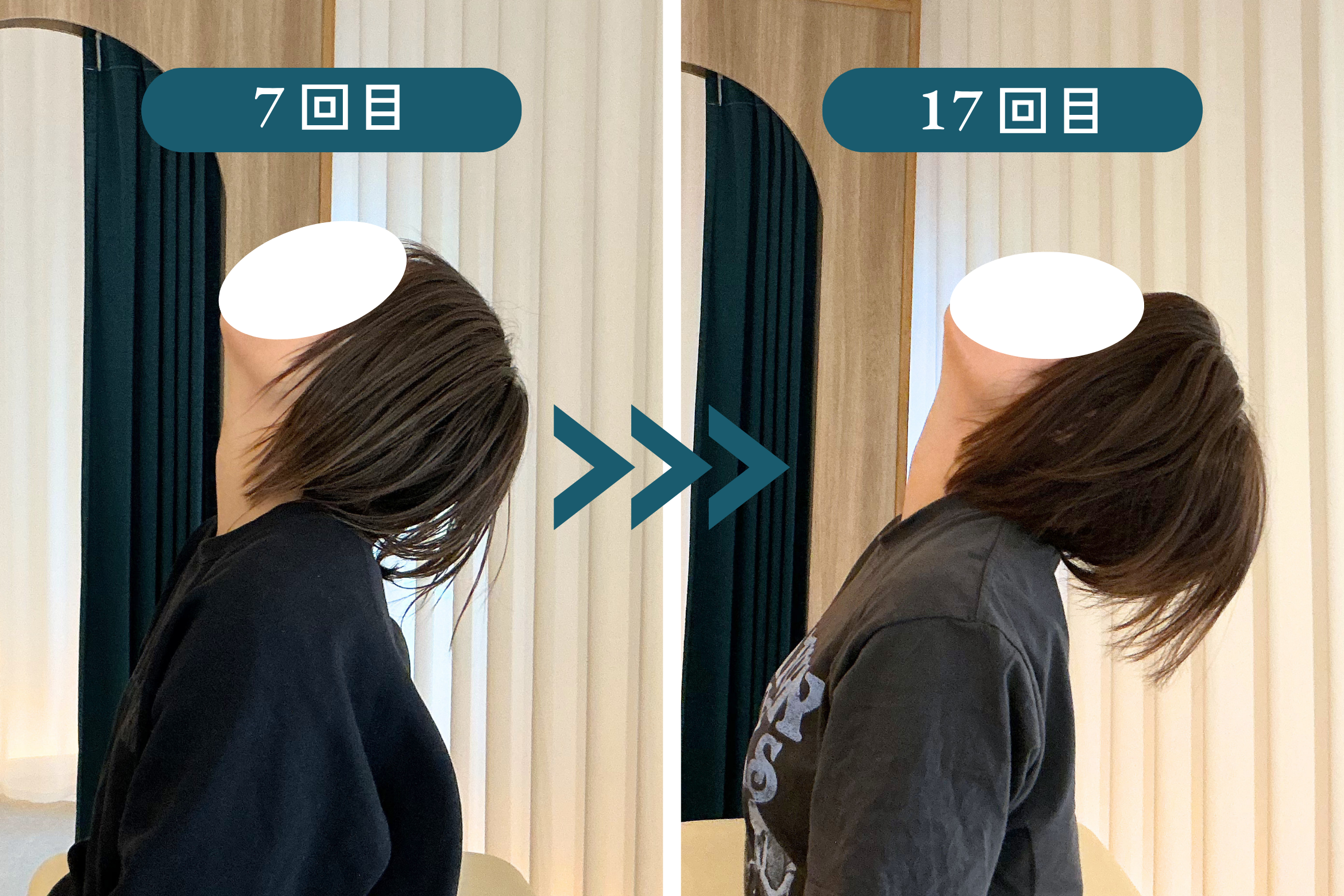 R様 施術7回目と14回目の比較。左肩甲骨周辺・姿勢のラインが段階的に整っている様子