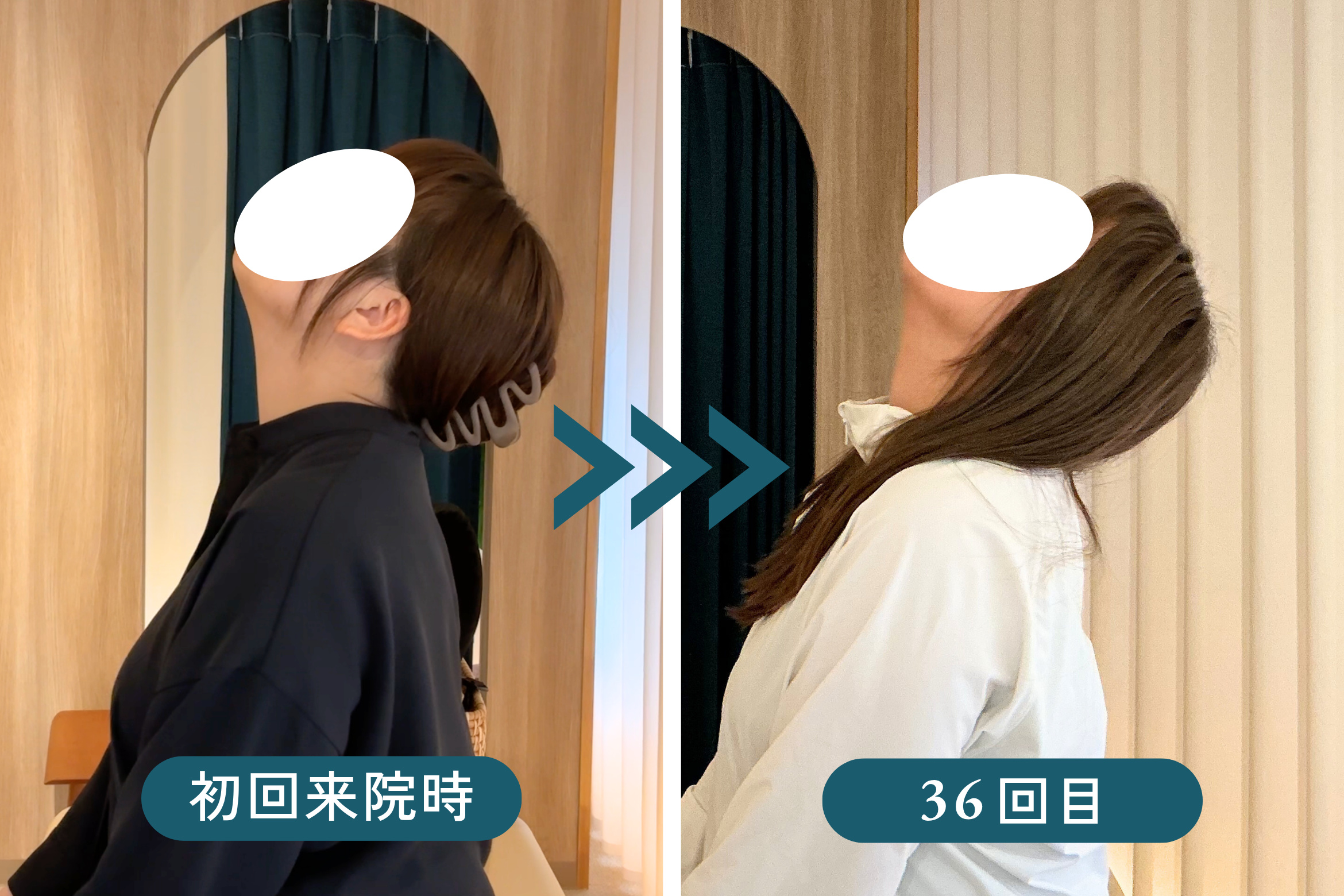 広島市中区大手町の慢性首肩こり 頸部後屈動作Before/After(矢状面)｜リリーフポート整体院 大手町店 H様
